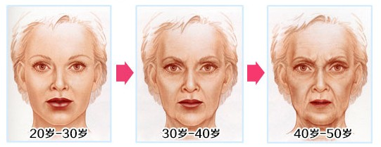 北京黄寺刘文阁超声提拉除皱案例