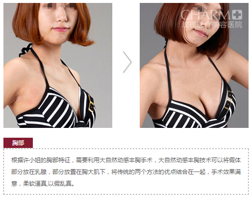 上海玫瑰整形医院赵克昶 上海玫瑰整形医院赵克昶